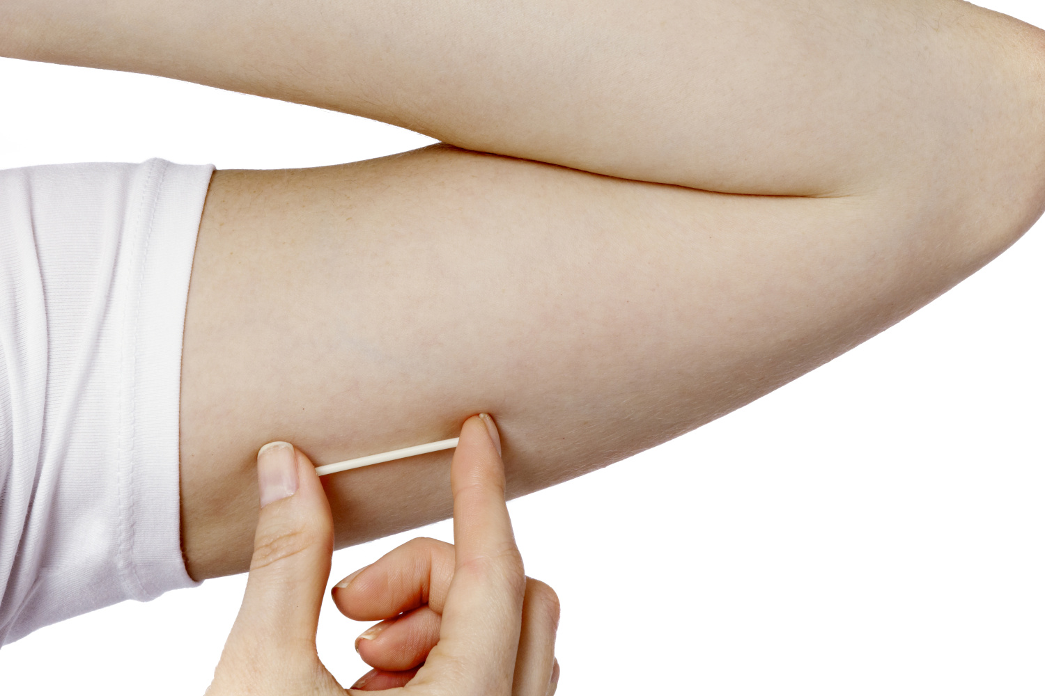 Implantes Hormonais